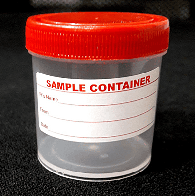 URINE CONTAINER - With Label (Non sterile)